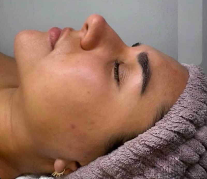 Piel después del Advanced Purifying & Detox Facial