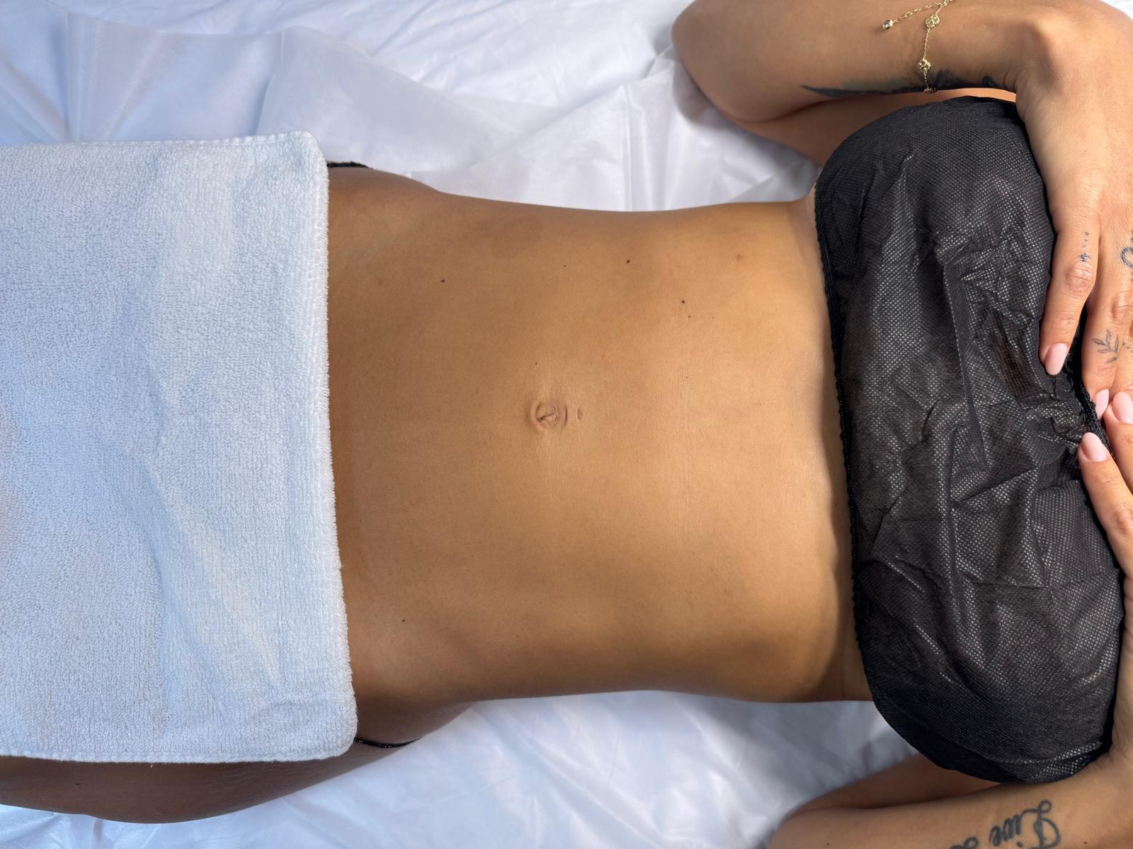 Abdomen antes de maderoterapia